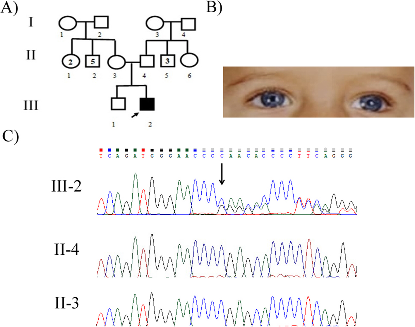 Fig. 3