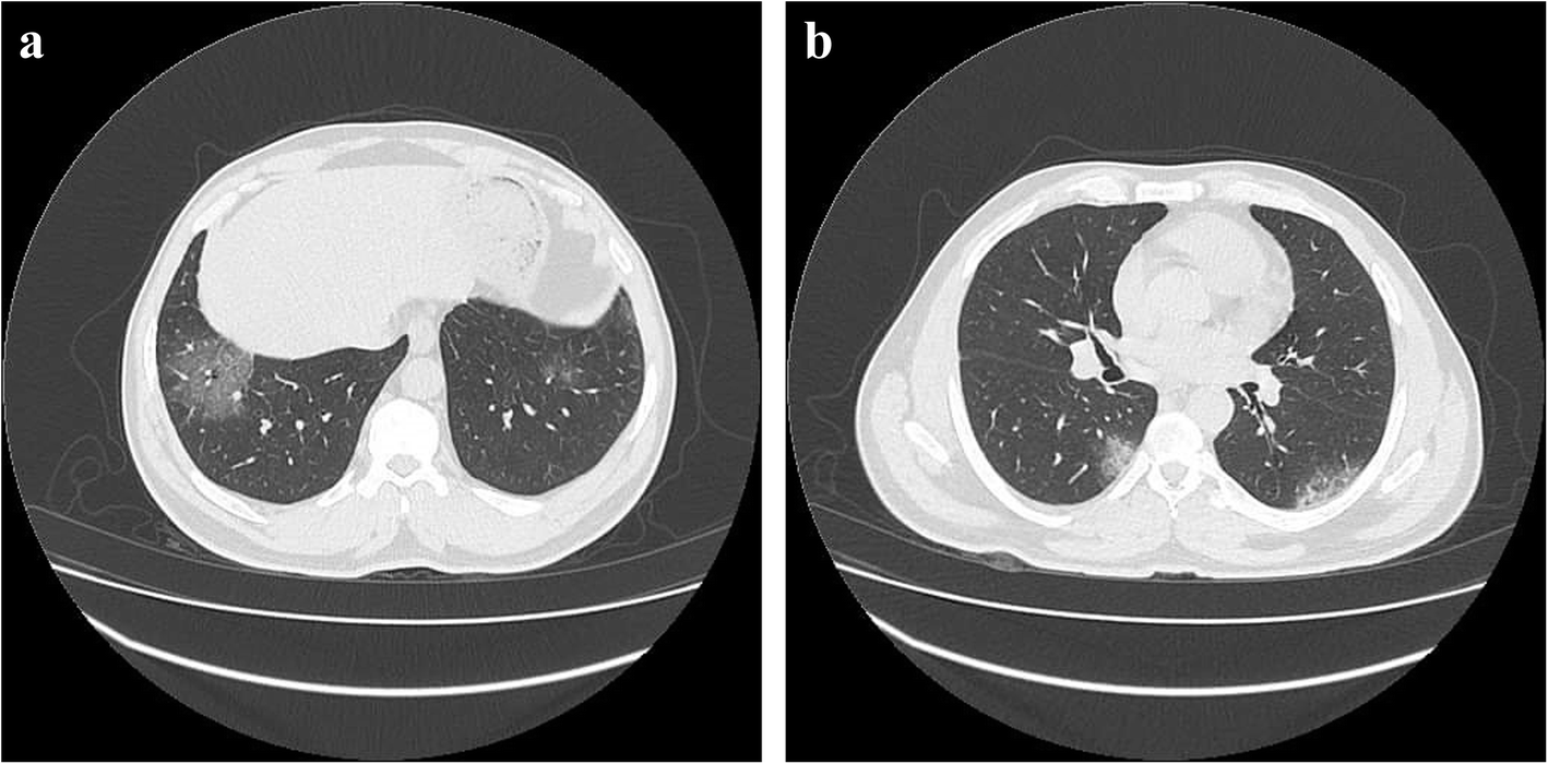 Fig. 2