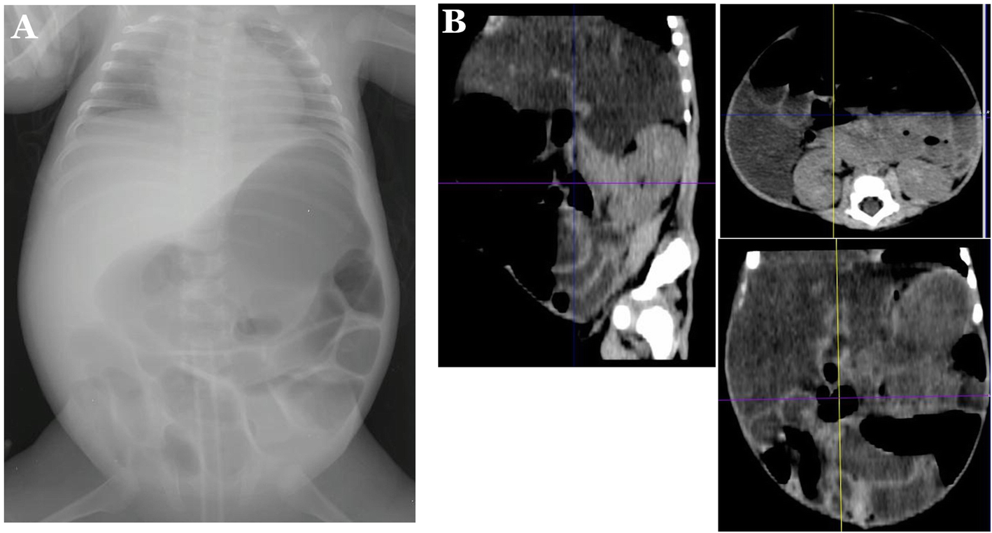 Fig. 1