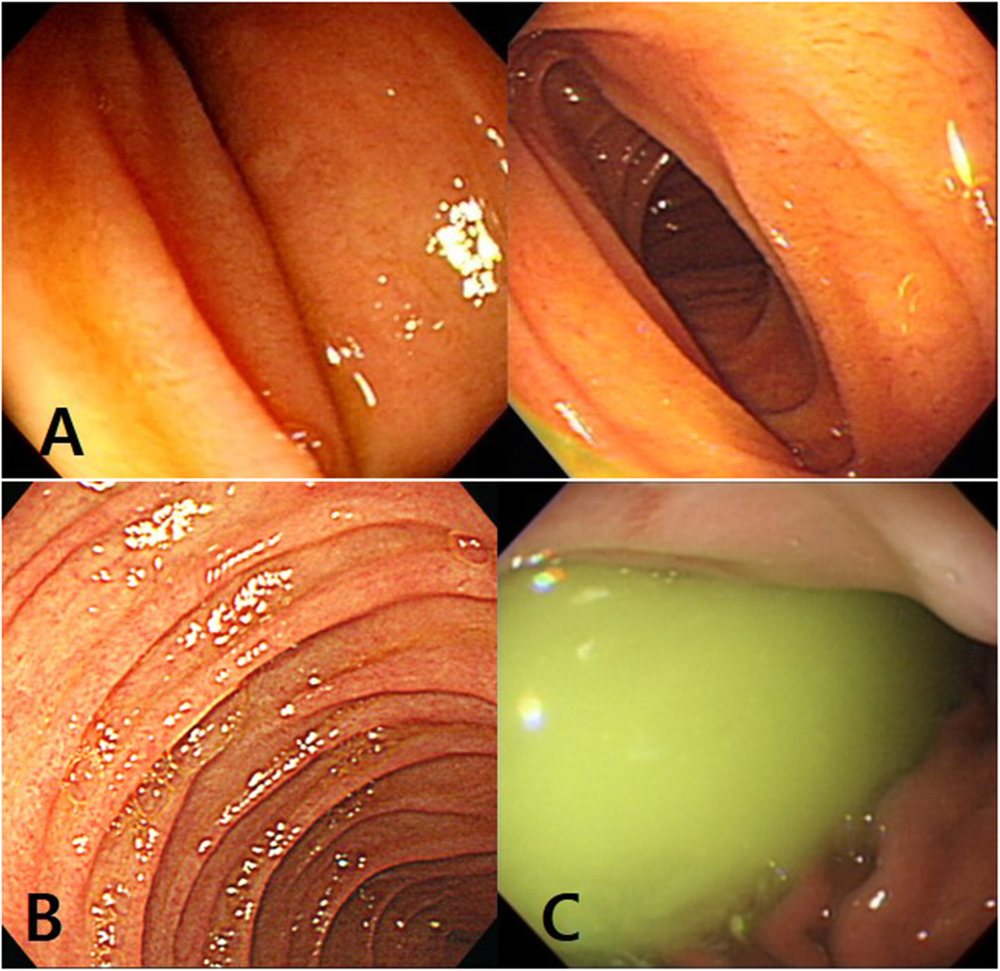 Fig. 1