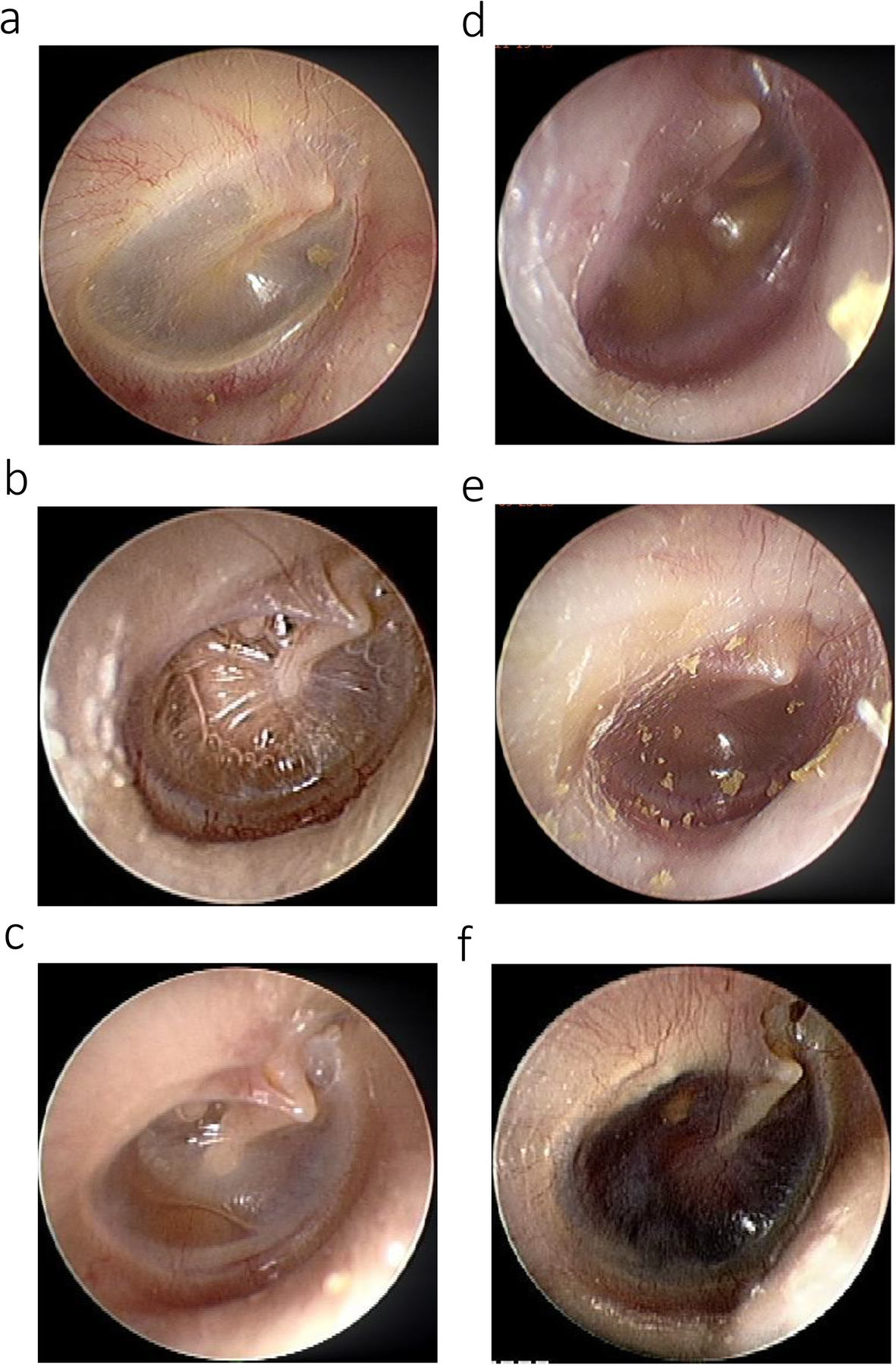 Fig. 1