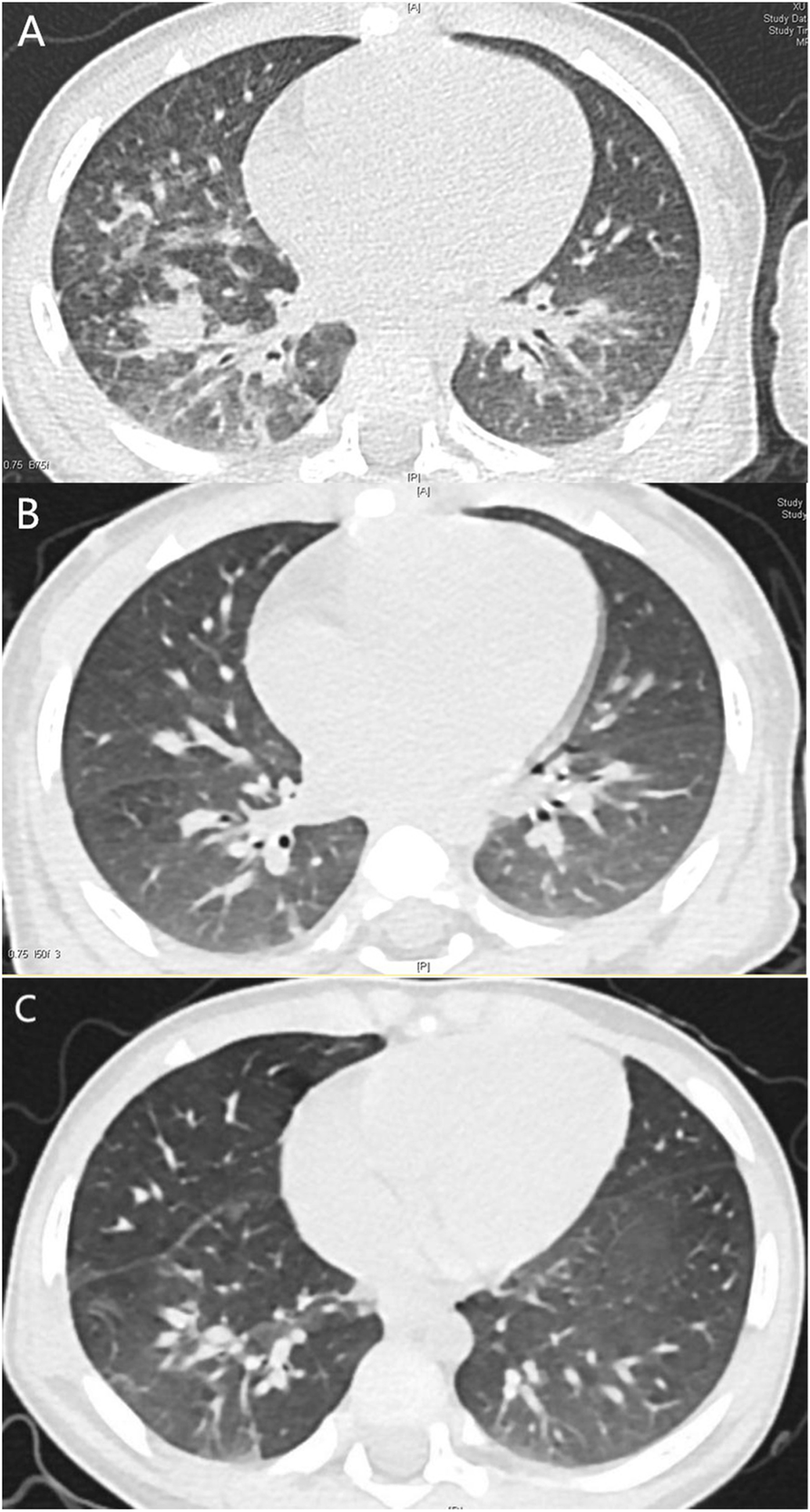 Fig. 1