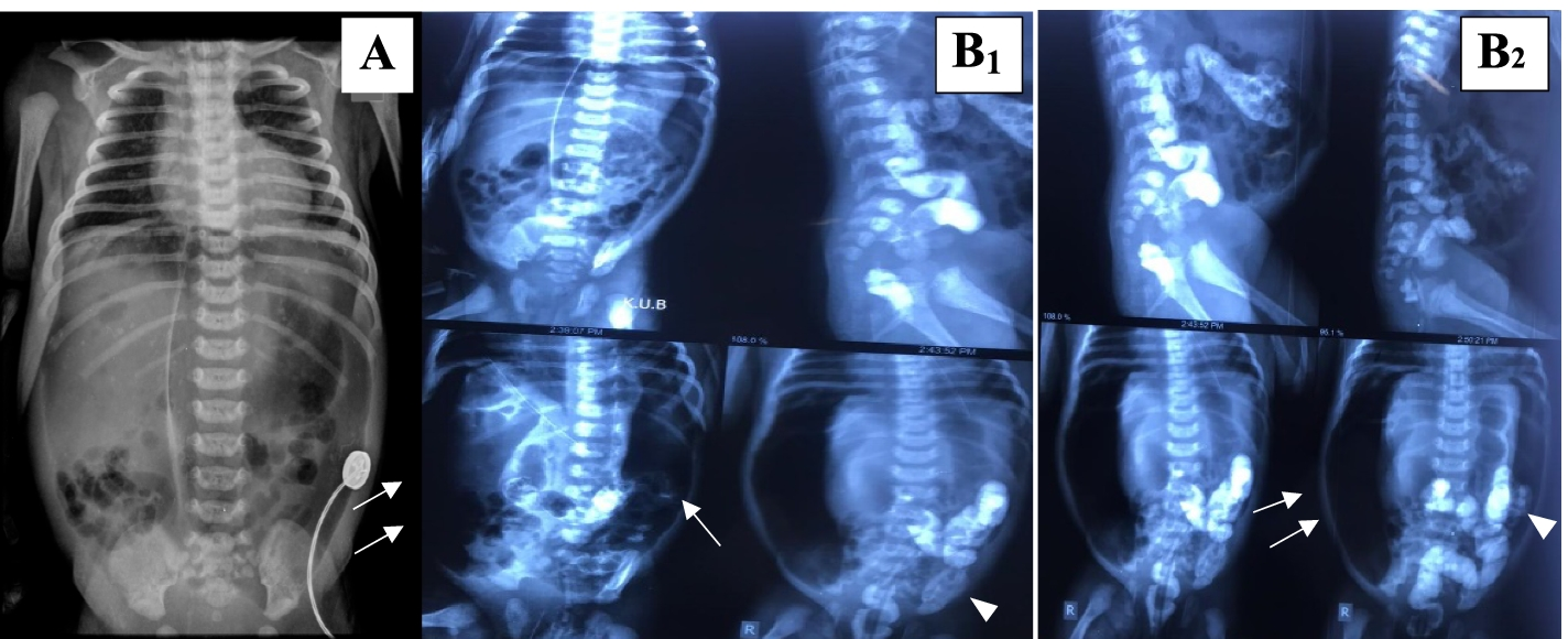 Fig. 1