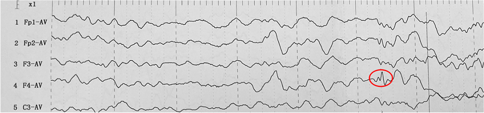 Fig. 1