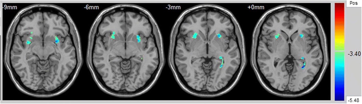 Fig. 2