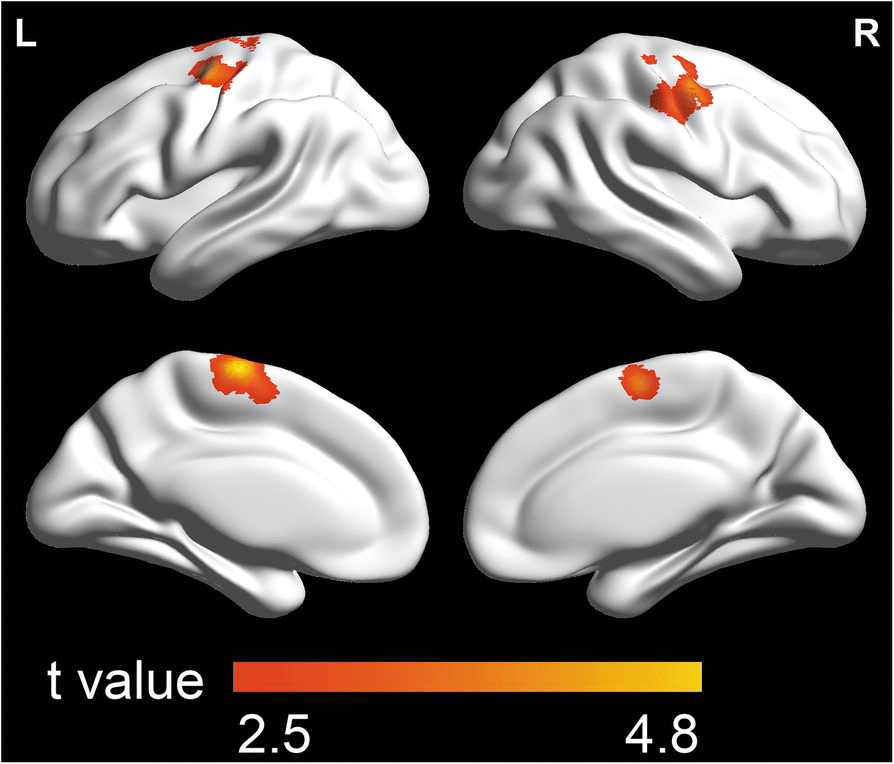 Fig. 4