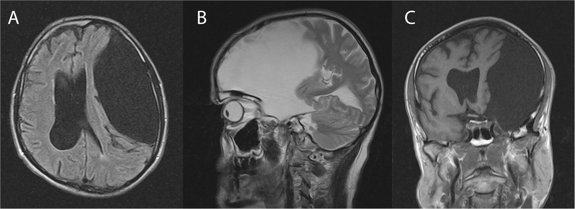 Fig. 1