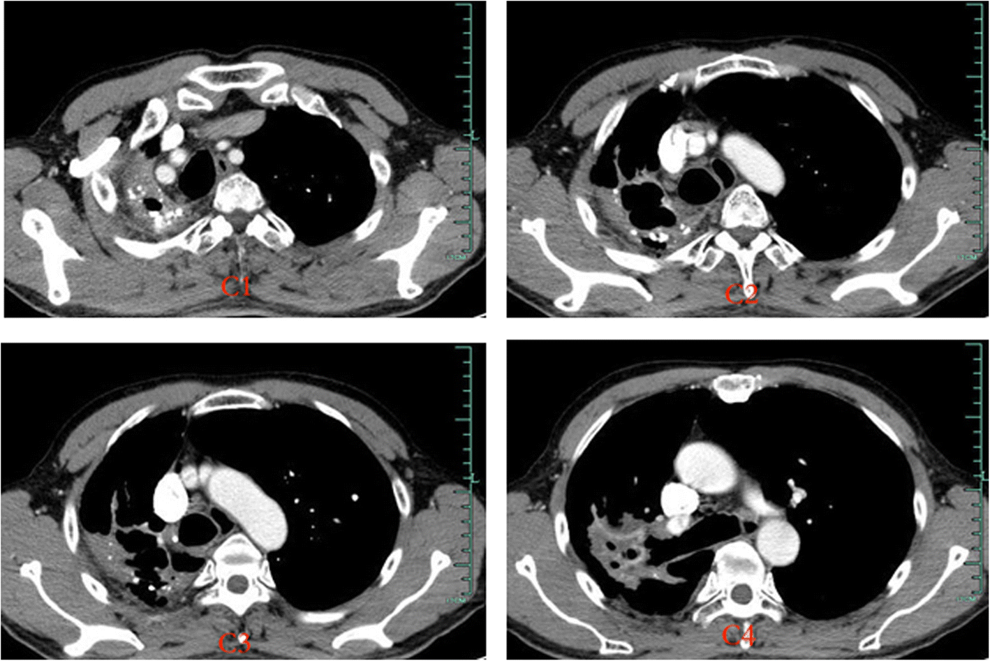 Fig. 3