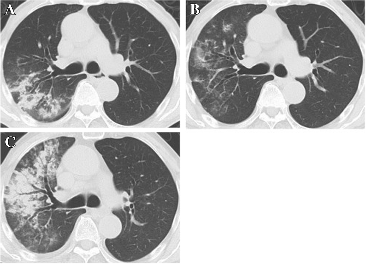 Fig. 2