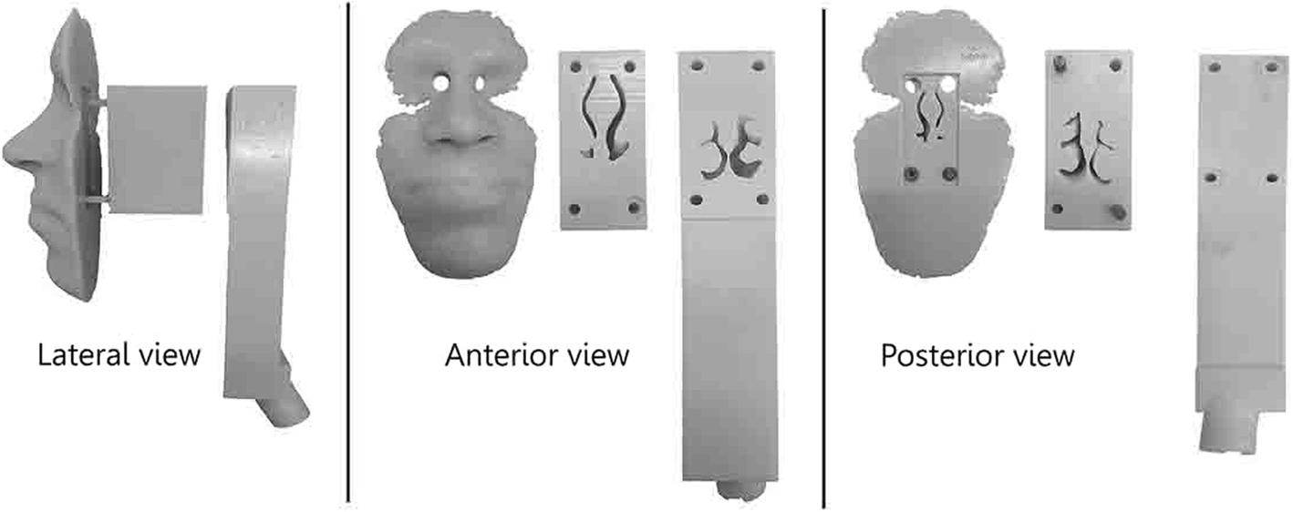 Fig. 2