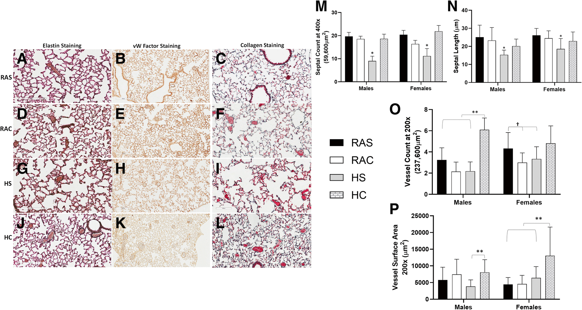 Caffeine Is Associated With Improved Alveolarization And Angiogenesis In Male Mice Following Hyperoxia Induced Lung Injury Bmc Pulmonary Medicine Full Text