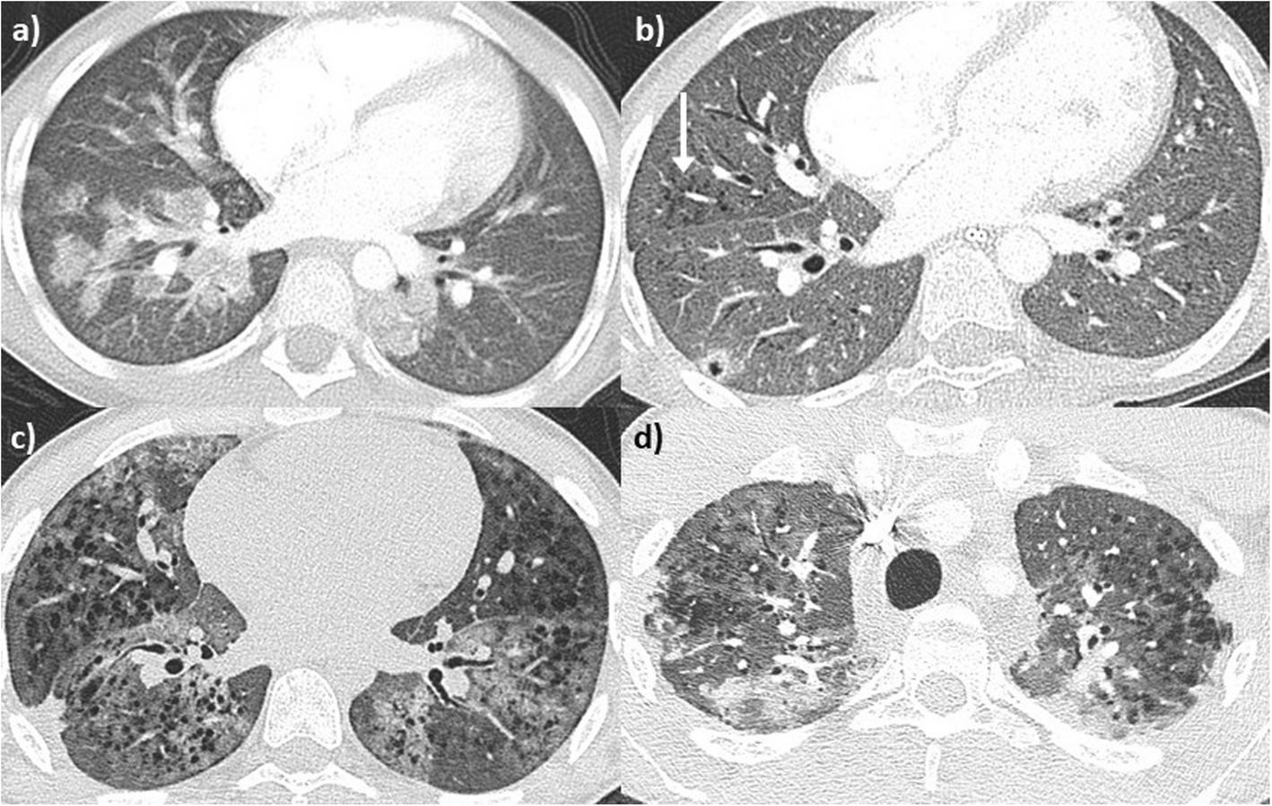 Fig. 5