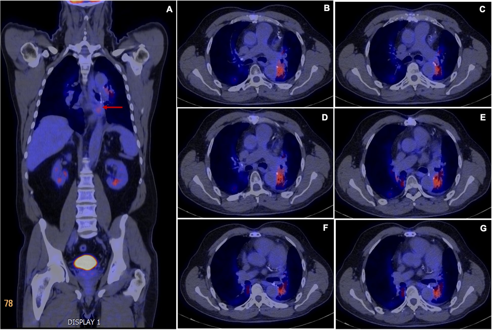 Fig. 1