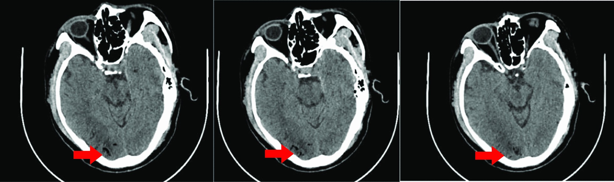 Fig. 5