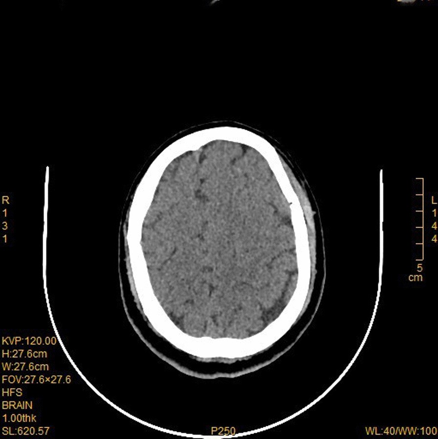 Fig. 6