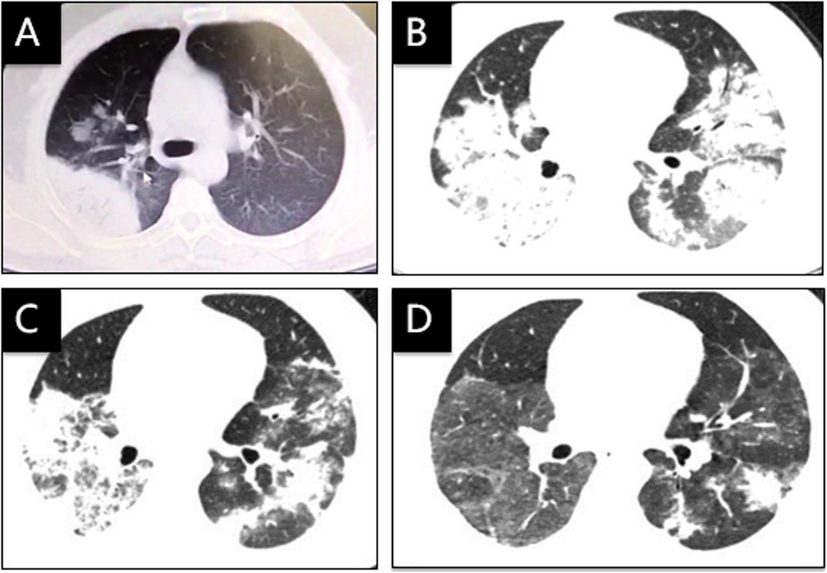 Fig. 2