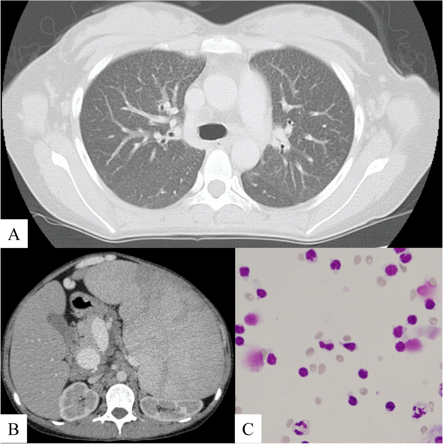 Fig. 1