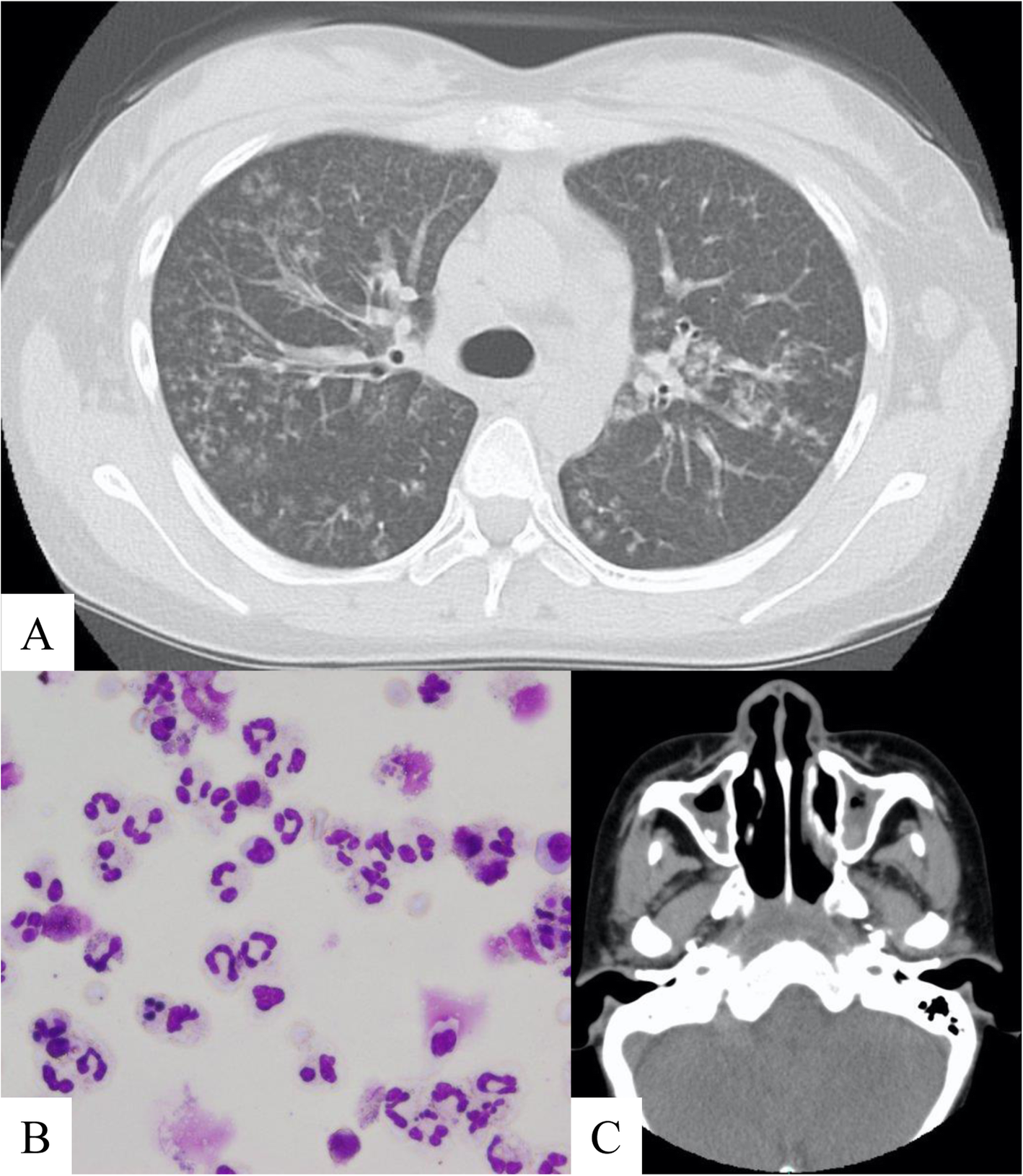 Fig. 3