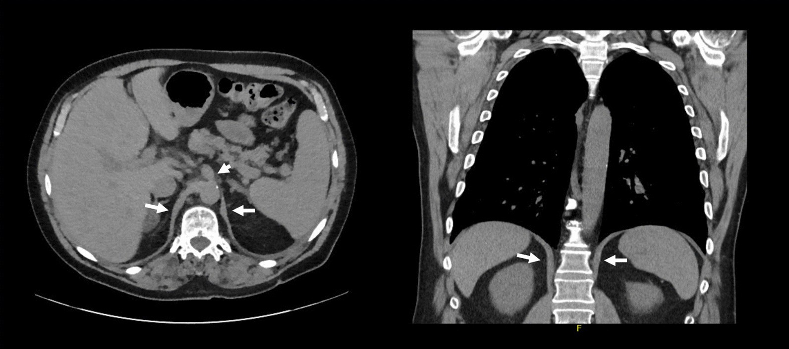 Fig. 10