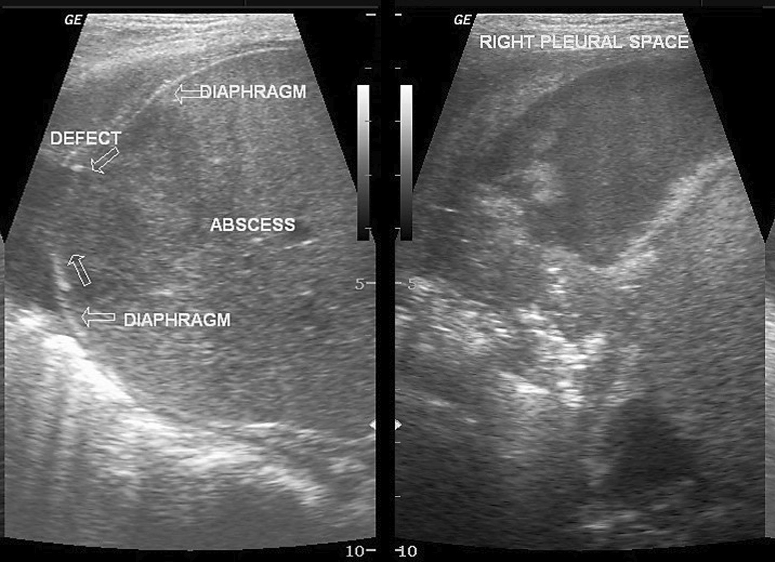 Fig. 25