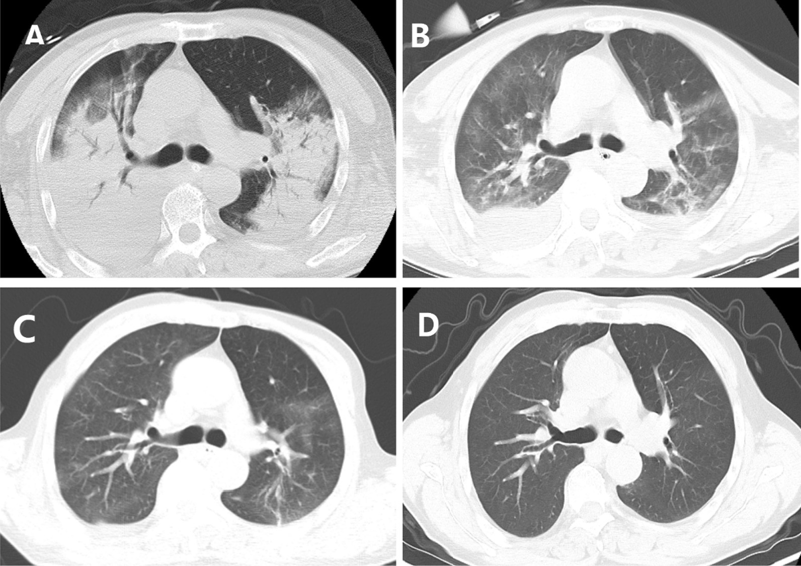 Fig. 2