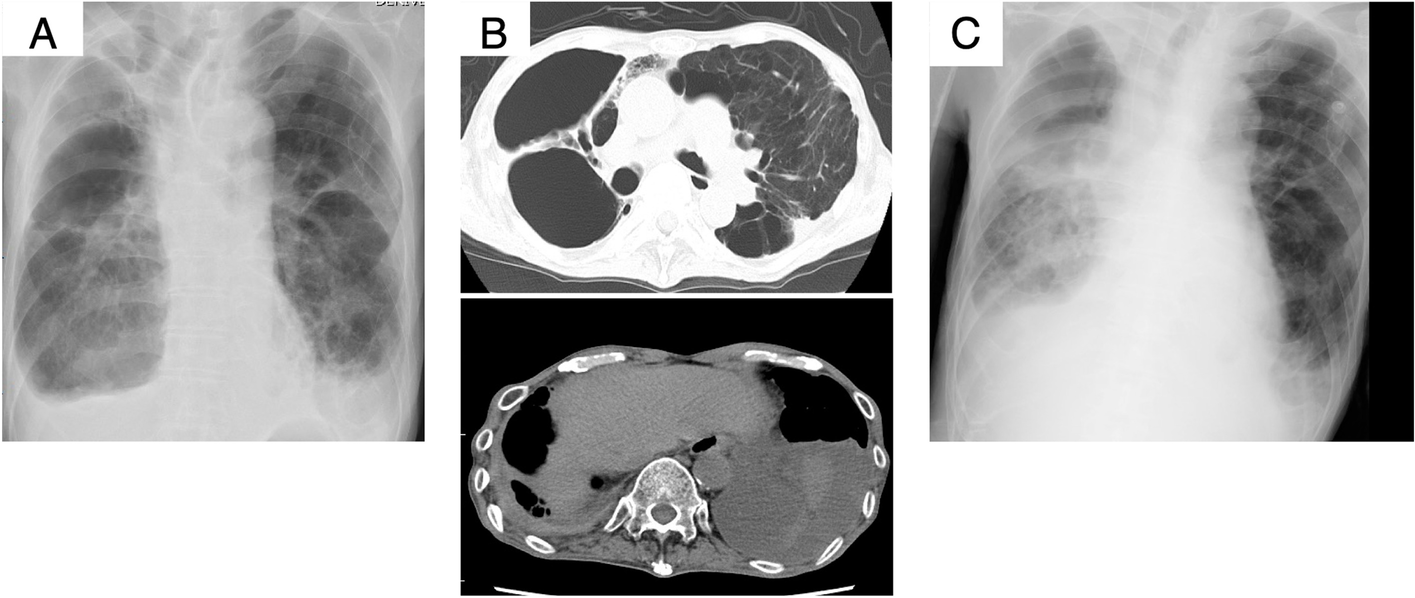 Fig. 1