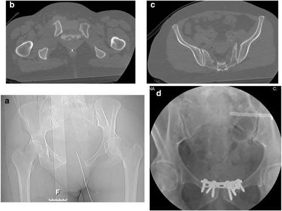 Fig. 1