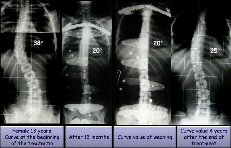 Fig. 3