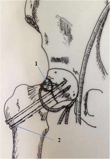 Fig. 2