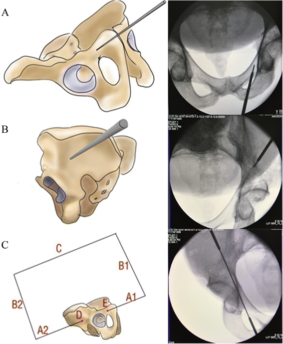 Fig. 2