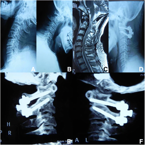 Fig. 3