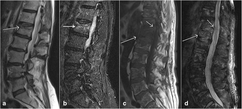 Fig. 12