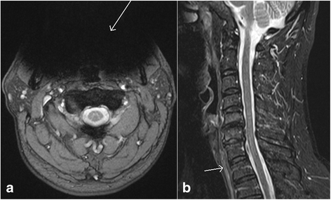 Fig. 13