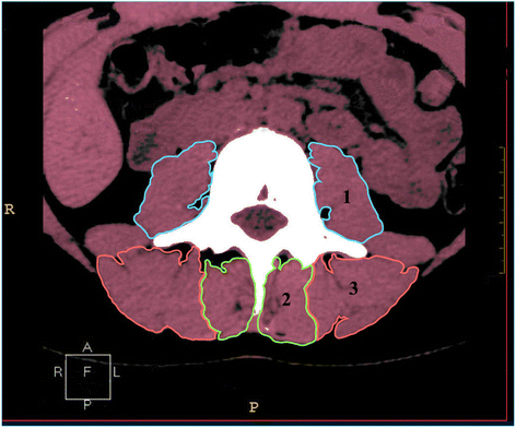 Fig. 3