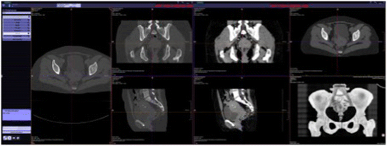 Fig. 3