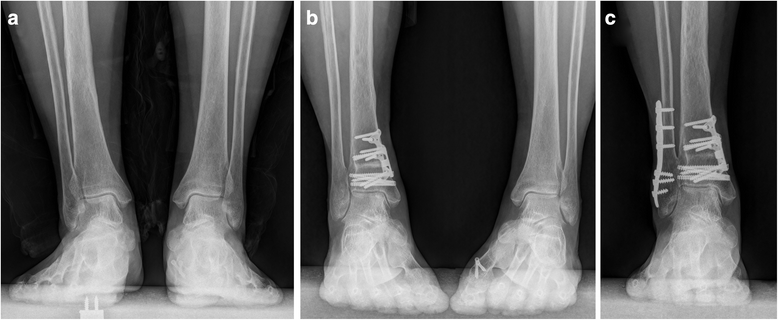 Fig. 10