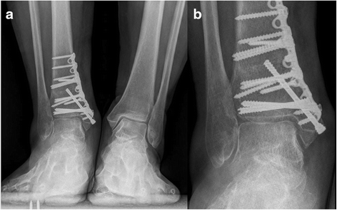 Fig. 7