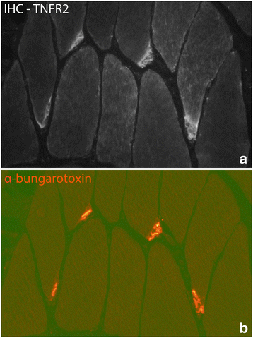 Fig. 14