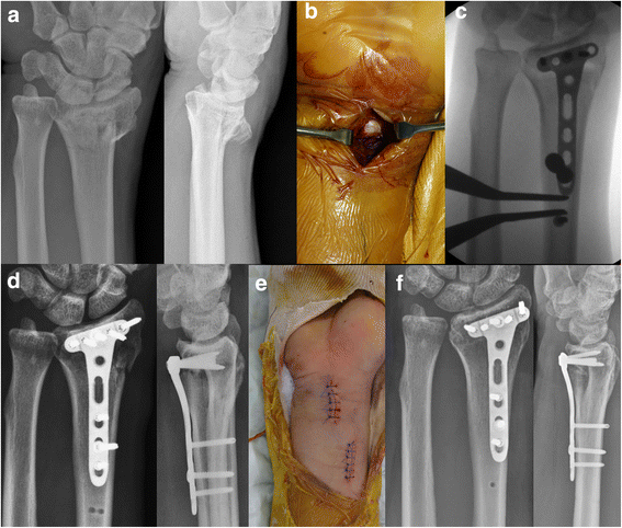 Fig. 2