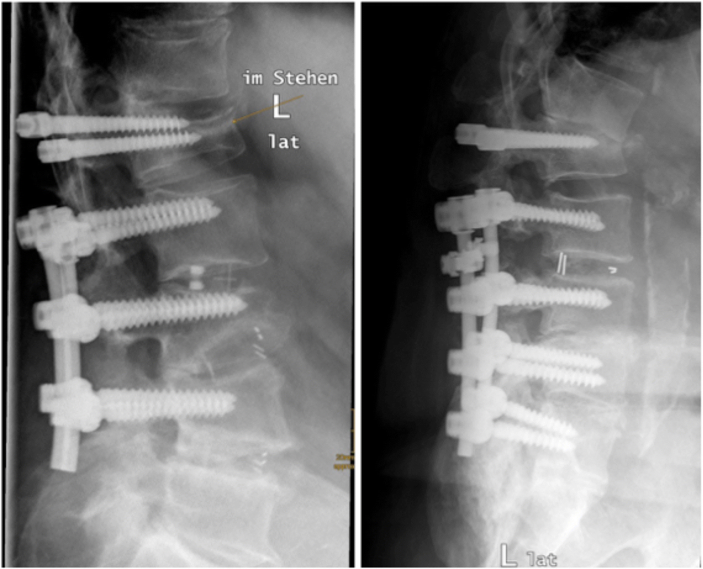 Fig. 10