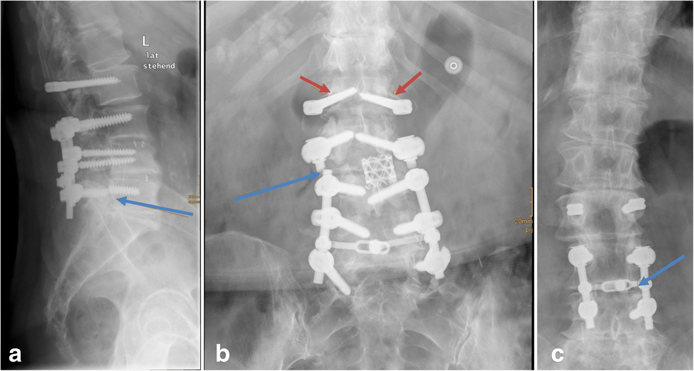 Fig. 9