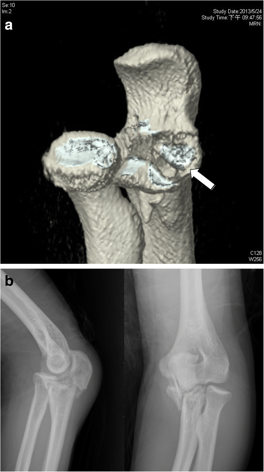 Fig. 2