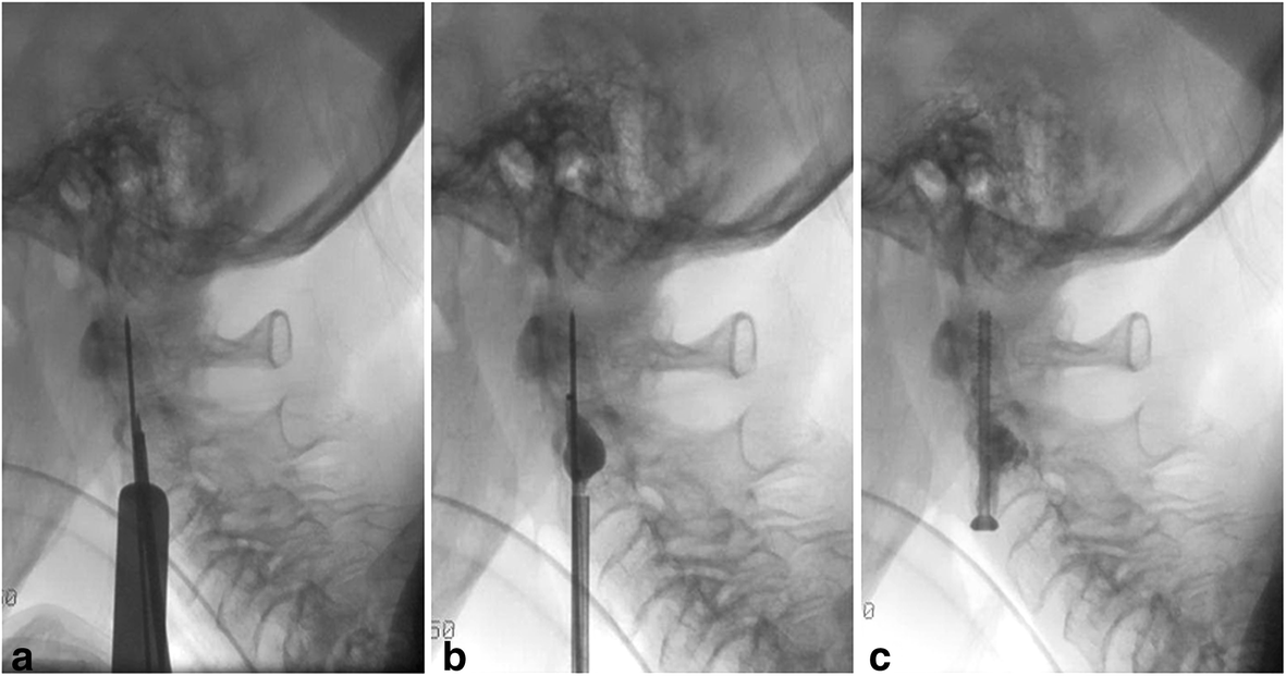 Fig. 3