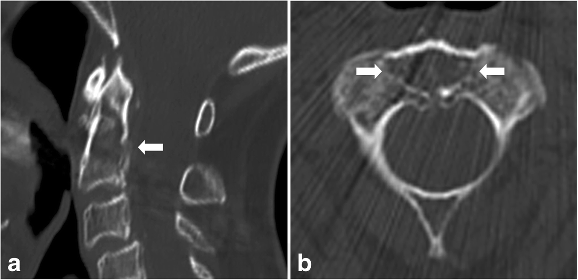 Fig. 6