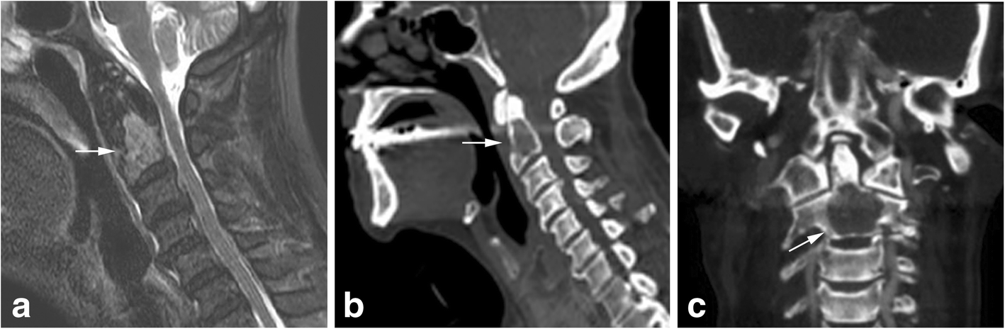 Fig. 8