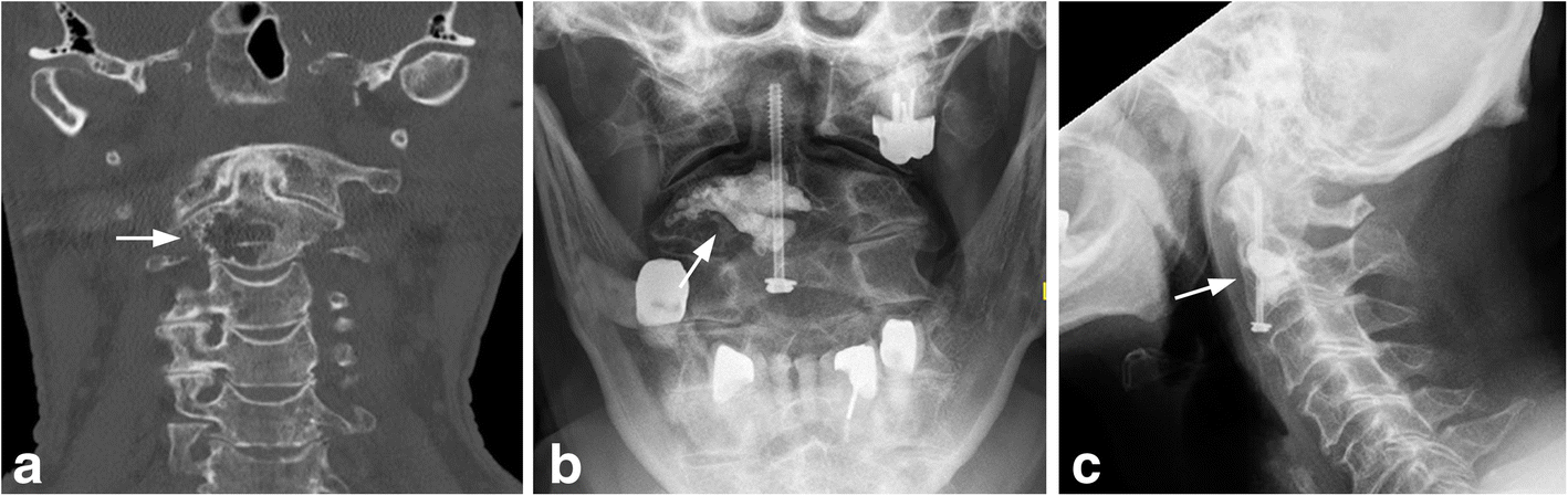 Fig. 9