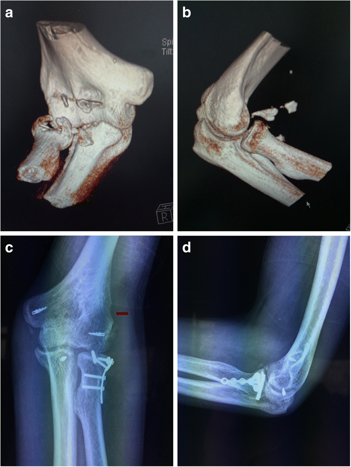 Fig. 2