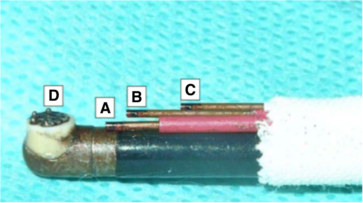 Fig. 2