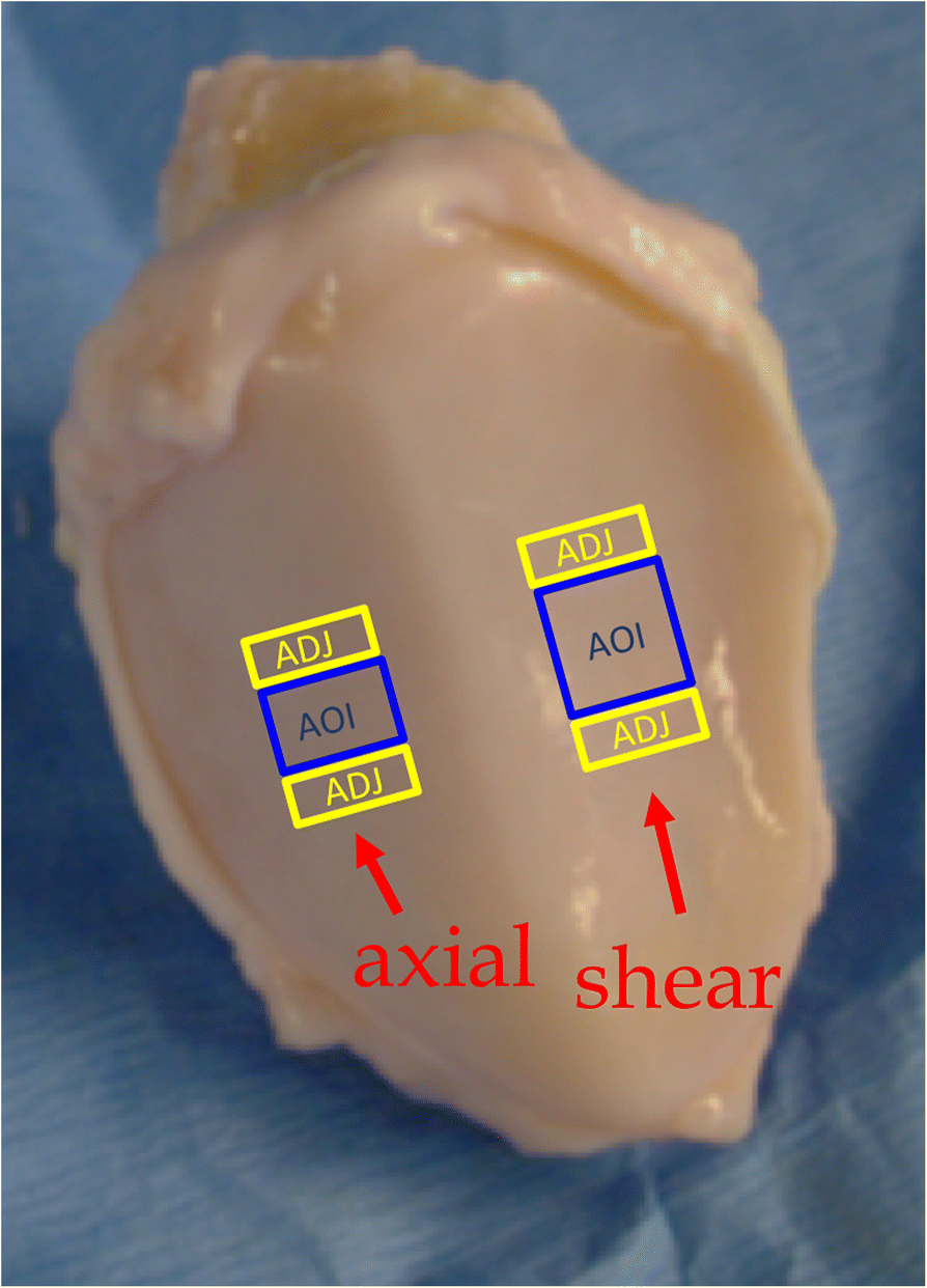 Fig. 2