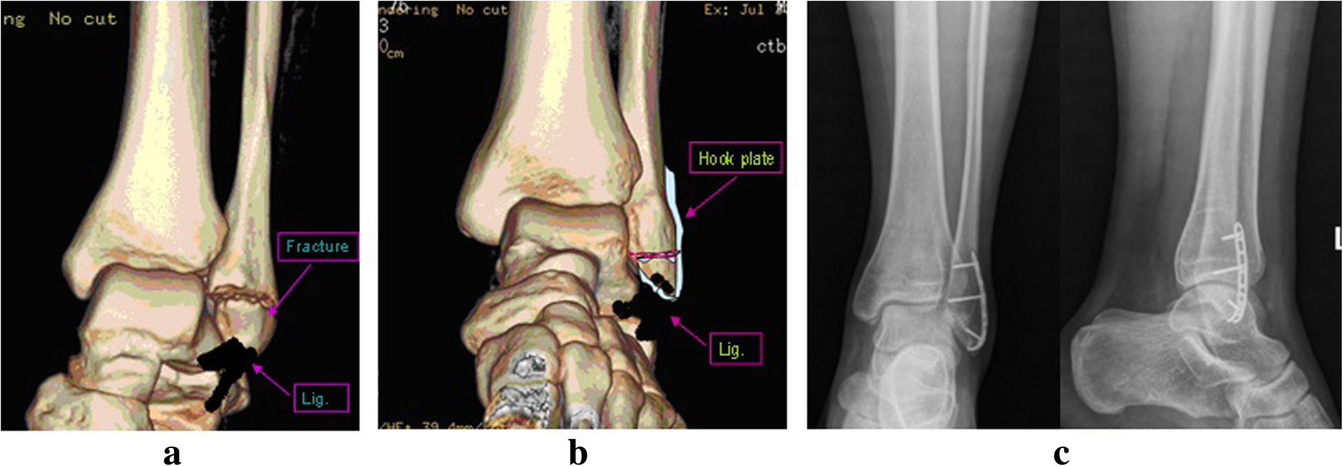 Fig. 4